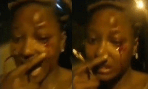 FUTA Female Student Left With Bloodied Eye After Being Assaulted By