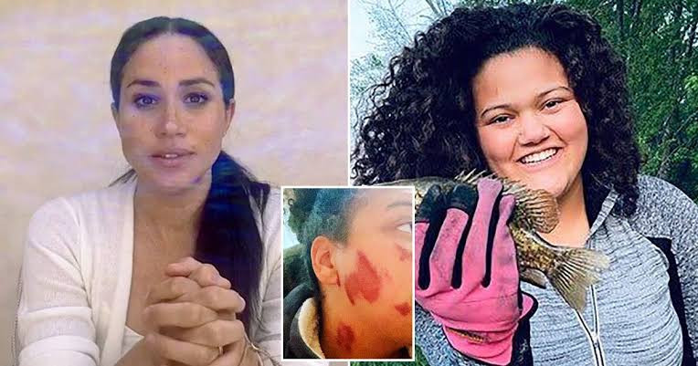 Meghan Markle calls black teenager "set on fire in racist ...
